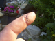 a51381-Sore Finger.jpg